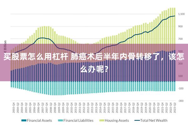 买股票怎么用杠杆 肺癌术后半年内骨转移了，该怎么办呢？